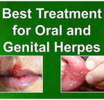 Herpes Formula