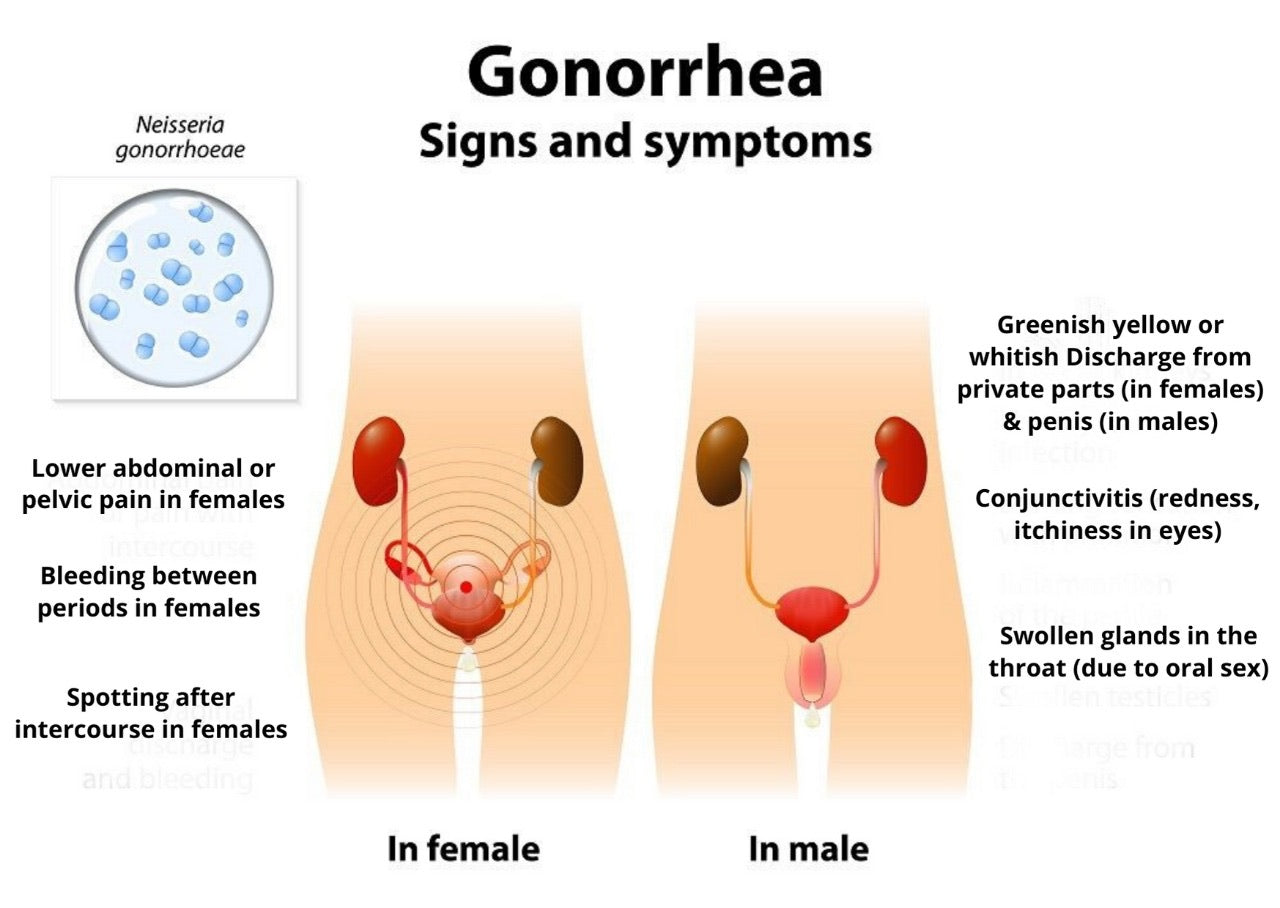 Gone-rhea